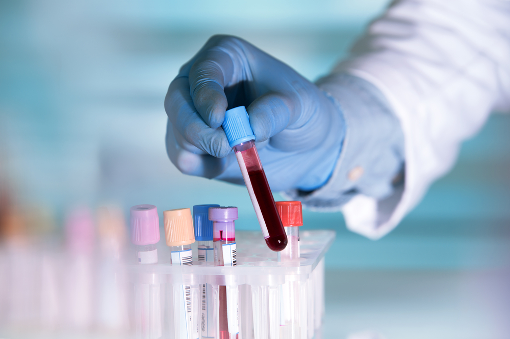 How Often Should You Get Blood Testing in Safety Harbor?
