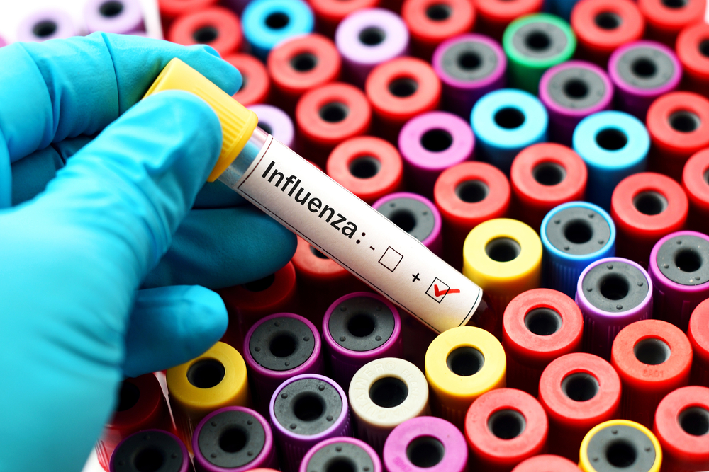 Come To Us When You Need Influenza Testing in Seminole