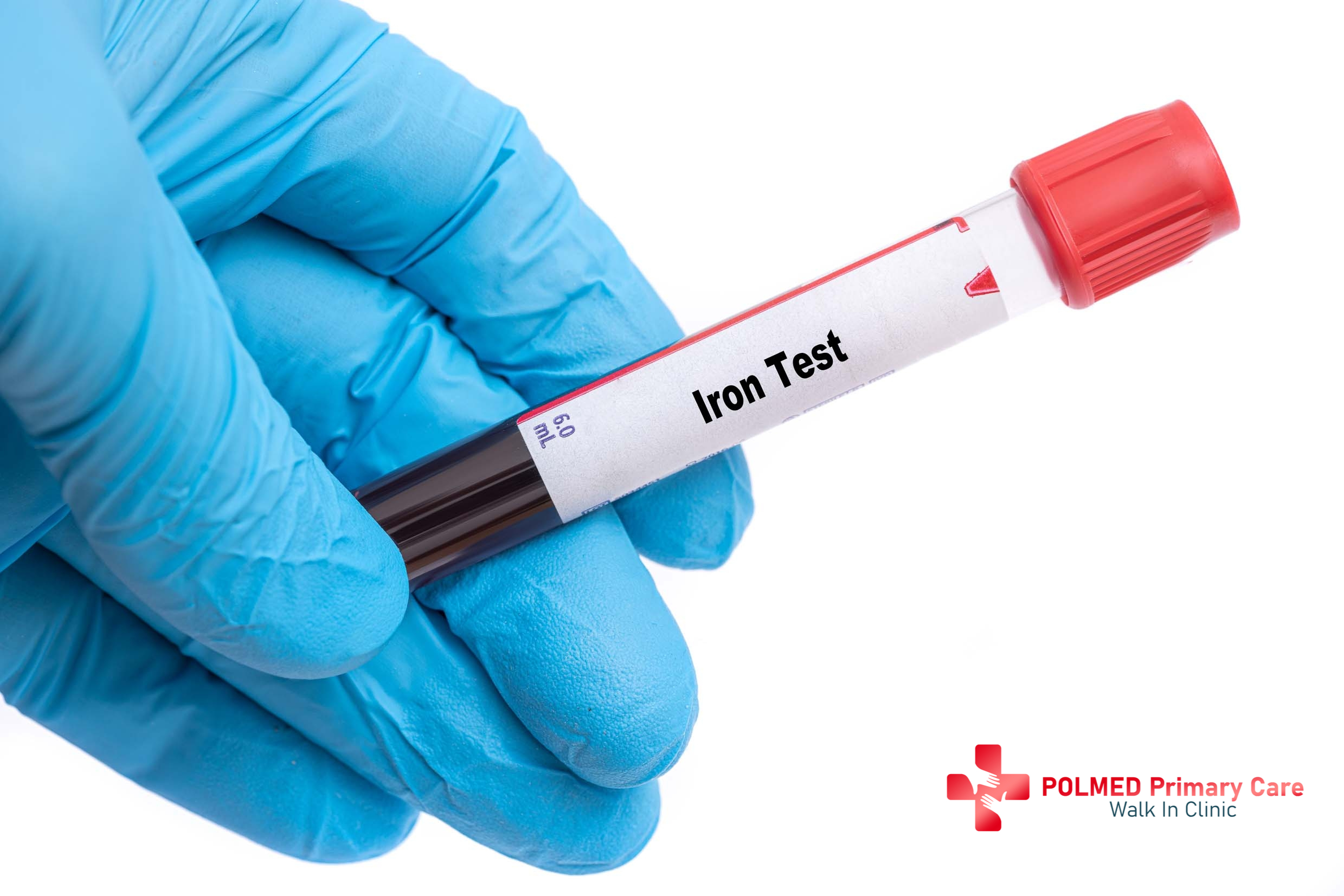 Polmed Primary Care & Walk-In Clinic Explains Why You May Need Iron Testing and Injections