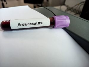 See Us For Mononucleosis Testing In New Port Richey