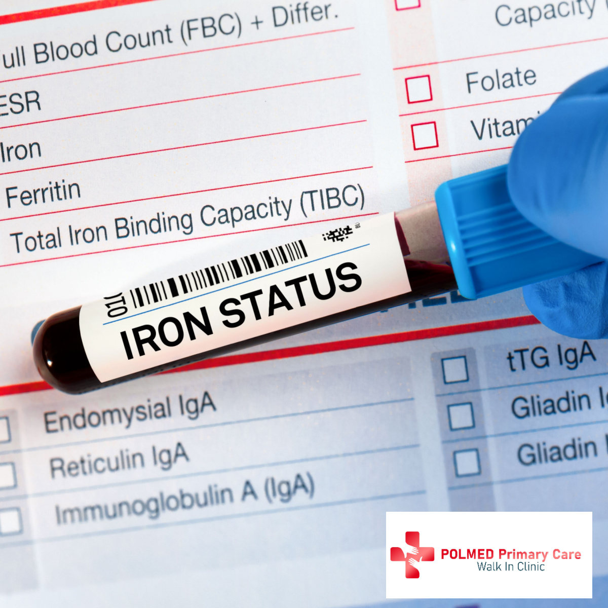 Iron Testing and Injections: Your Solution to Fatigue and Anemia in Tampa